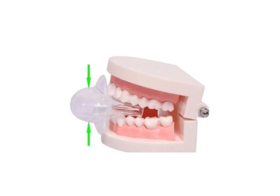 anti-snoring-tongue-device
