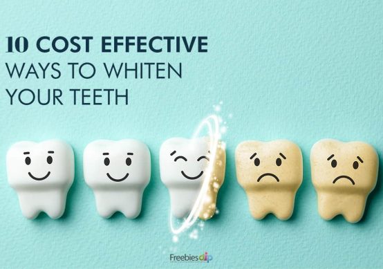 How Much Does Teeth Whitening Cost?